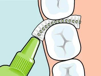 牙間刷清潔前牙牙縫